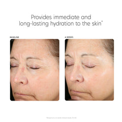 PCA SKIN Hyaluronic Acid Boosting Serum (1 fl. oz.)