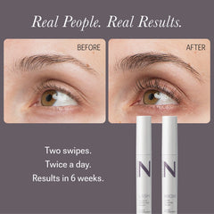 NULASTIN Solution Serum System