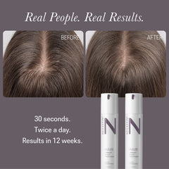 NULASTIN Solution Serum System