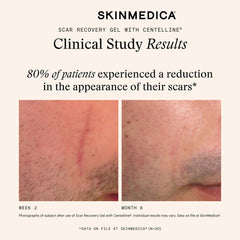 SkinMedica Scar Recovery Gel with Centelline® (2 oz.)
