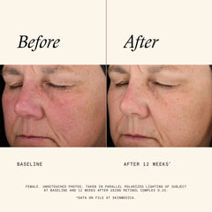 SkinMedica Age Defense Retinol Complex 0.25 (1 fl. oz.)
