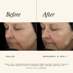 SkinMedica TNS® Advanced+ Serum (1 fl. oz.)